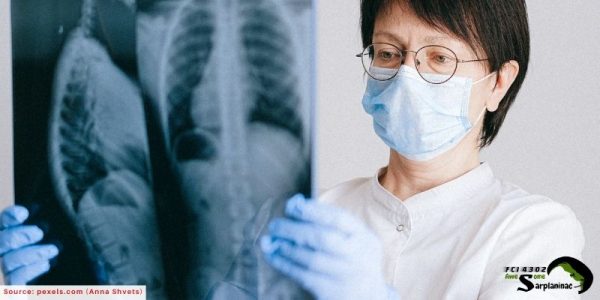 Doctor examining a chest X-ray scan
